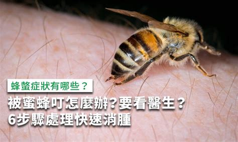 趕走蜜蜂|【小心被峰叮】河水不犯井水？滅蟲專家教你分辨蜂種及應對方法